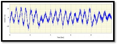 What Is Amplitude Quantization Error