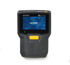  vibscanner-2